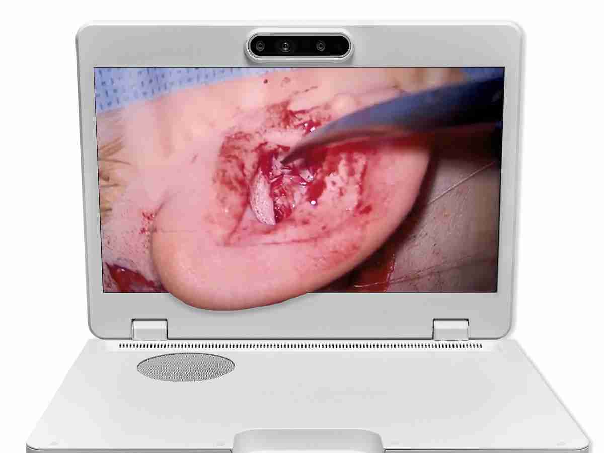 达擎之＂Heads-up 3D显微手术显示系统＂，，，整合4K裸眼3D显示及眼球追踪系统，，，，具备快速追踪人眼移动位置功能，，减轻医师长时间维持固定姿势的负担，，让医师能有更宽广清晰的3D立体视野及更舒适的姿势来执行手术。。